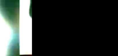 گزارش ویدوئی به مناسبت روز جهانی خیرین در کنار پزشکان داوطلب حامی بیماران سی اف 